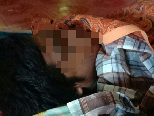 Bocah terjatuh dijembatan