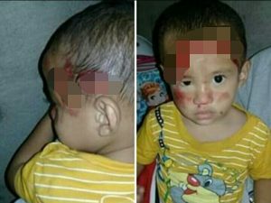 Bocah 2 Tahun Anak Kadus Mampua Jadi Korban Tabrak Lari, Plat Mobil Berhasil Terbaca