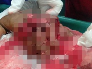 RSUD Cileungsi Bogor Diduga Terelantarkan Penanganan Pasien, Ini kata Kelurga pasien