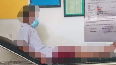 Andi Fajri saat di visum di Puskesmas Manipi,