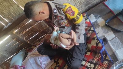 Kisah Pilu Stevano Yota: Harapan Hidup Balita Atresia Ani di Manggarai Timur dan Peran Mulia Aipda Sukiman