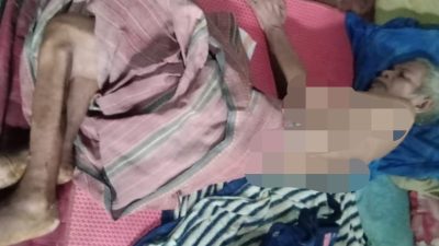 Kisah Damianus Lanur: Tiga Tahun Terbaring Lumpuh, Harapkan Uluran Tangan Pemerintah dan Masyarakat